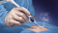 Open smoke evacuation surgical device system