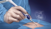 Open smoke evacuation surgical device system